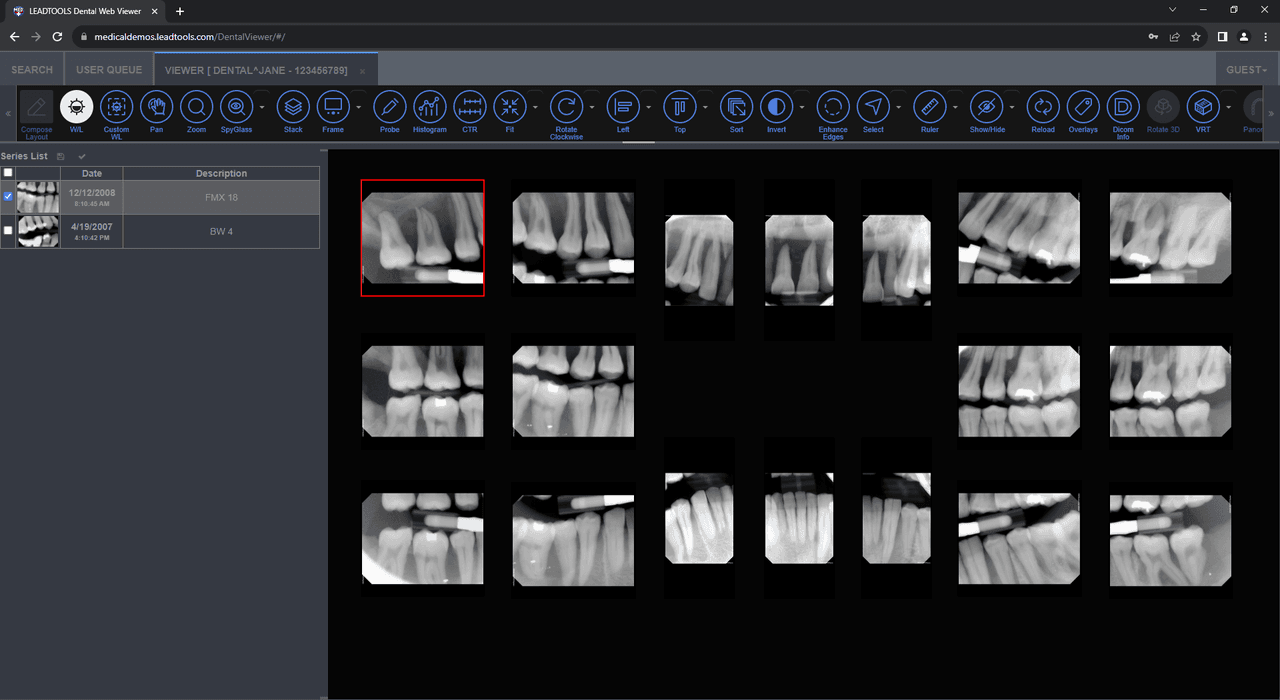 Experience the dental-focused version of the LEADTOOLS Medical Web Viewer, which has custom views and tools suited for dentists and oral surgeons.