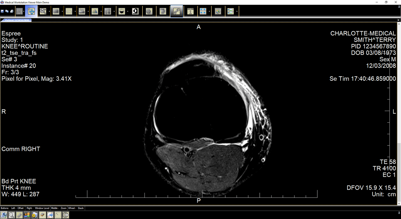 Explore a feature-rich client workstation for viewing DICOM images.