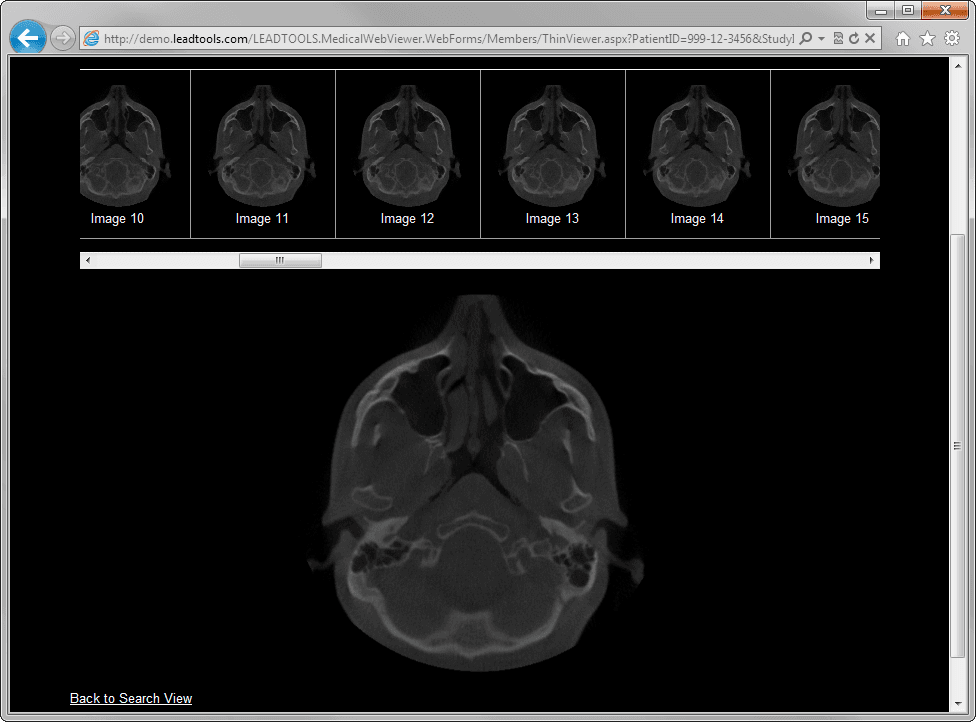 LEADTOOLS Medical HTML5 Module launched