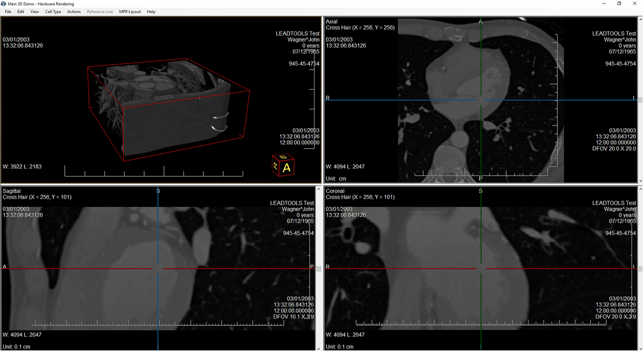 View and create 3D volumetric DICOM renderings.